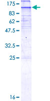 HMG-CoA Reductase / HMGCR Protein - 12.5% SDS-PAGE of human HMGCR stained with Coomassie Blue