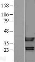 HMG1 / HMGB1 Protein - Western validation with an anti-DDK antibody * L: Control HEK293 lysate R: Over-expression lysate
