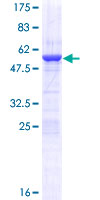 HMG1 / HMGB1 Protein - 12.5% SDS-PAGE of human HMGB1 stained with Coomassie Blue
