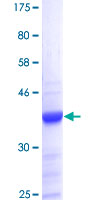 HMG1 / HMGB1 Protein - 12.5% SDS-PAGE Stained with Coomassie Blue.