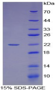 HMG1 / HMGB1 Protein - Recombinant High Mobility Group Protein 1 By SDS-PAGE