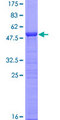 HMG2 / HMGB2 Protein - 12.5% SDS-PAGE of human HMGB2 stained with Coomassie Blue