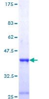 HMG2 / HMGB2 Protein - 12.5% SDS-PAGE Stained with Coomassie Blue.