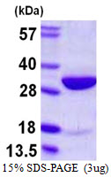 HMG2 / HMGB2 Protein