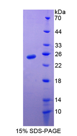 HMG2 / HMGB2 Protein - Recombinant  High Mobility Group Box Protein 2 By SDS-PAGE