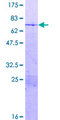 HMG20A Protein - 12.5% SDS-PAGE of human HMG20A stained with Coomassie Blue
