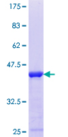 HMG20A Protein - 12.5% SDS-PAGE Stained with Coomassie Blue.