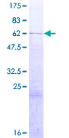 HMG20B / BRAF35 Protein - 12.5% SDS-PAGE of human HMG20B stained with Coomassie Blue