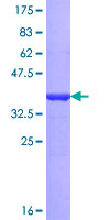 HMG20B / BRAF35 Protein - 12.5% SDS-PAGE Stained with Coomassie Blue.