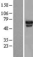 HMG2L1 / HMGXB4 Protein - Western validation with an anti-DDK antibody * L: Control HEK293 lysate R: Over-expression lysate