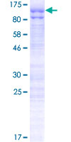 HMG2L1 / HMGXB4 Protein - 12.5% SDS-PAGE of human HMG2L1 stained with Coomassie Blue