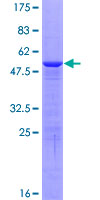 HMGB3 Protein - 12.5% SDS-PAGE of human HMGB3 stained with Coomassie Blue