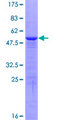 HMGB3 Protein - 12.5% SDS-PAGE of human HMGB3 stained with Coomassie Blue