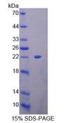 HMGB4 Protein - Recombinant High Mobility Group Box Protein 4 (HMGB4) by SDS-PAGE