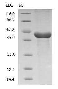 HMGCL Protein - (Tris-Glycine gel) Discontinuous SDS-PAGE (reduced) with 5% enrichment gel and 15% separation gel.