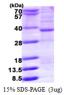 HMGCL Protein