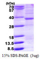 HMGCL Protein