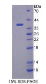 HMGCL Protein - Recombinant 3-Hydroxymethyl-3-Methylglutaryl Coenzyme A Lyase (HMGCL) by SDS-PAGE