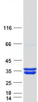 HMGCL Protein - Purified recombinant protein HMGCL was analyzed by SDS-PAGE gel and Coomassie Blue Staining