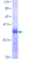 HMGCS1 / HMG-CoA Synthase 1 Protein - 12.5% SDS-PAGE Stained with Coomassie Blue.