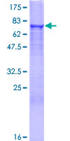 HMGCS2 / HMG-CoA Synthase 2 Protein - 12.5% SDS-PAGE of human HMGCS2 stained with Coomassie Blue