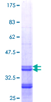 HMGCS2 / HMG-CoA Synthase 2 Protein - 12.5% SDS-PAGE Stained with Coomassie Blue.