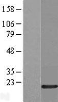 HMGIY / HMGA1 Protein - Western validation with an anti-DDK antibody * L: Control HEK293 lysate R: Over-expression lysate