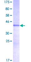 HMGIY / HMGA1 Protein - 12.5% SDS-PAGE of human HMGA1 stained with Coomassie Blue