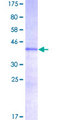 HMGIY / HMGA1 Protein - 12.5% SDS-PAGE of human HMGA1 stained with Coomassie Blue