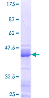 HMGIY / HMGA1 Protein - 12.5% SDS-PAGE Stained with Coomassie Blue.