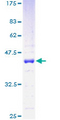 HMGN1 / HMG14 Protein - 12.5% SDS-PAGE of human HMGN1 stained with Coomassie Blue