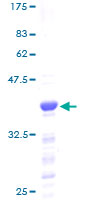 HMGN2 Protein - 12.5% SDS-PAGE of human HMGN2 stained with Coomassie Blue