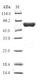 HMGN2 Protein - (Tris-Glycine gel) Discontinuous SDS-PAGE (reduced) with 5% enrichment gel and 15% separation gel.