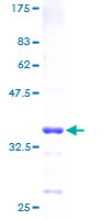 HMGN3 Protein - 12.5% SDS-PAGE of human HMGN3 stained with Coomassie Blue