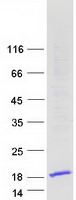 HMGN3 Protein - Purified recombinant protein HMGN3 was analyzed by SDS-PAGE gel and Coomassie Blue Staining