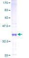 HMGN4 Protein - 12.5% SDS-PAGE of human HMGN4 stained with Coomassie Blue