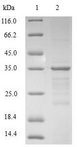 HMGN4 Protein - (Tris-Glycine gel) Discontinuous SDS-PAGE (reduced) with 5% enrichment gel and 15% separation gel.