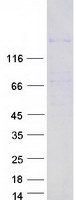 HMGXB3 / SMF Protein - Purified recombinant protein HMGXB3 was analyzed by SDS-PAGE gel and Coomassie Blue Staining