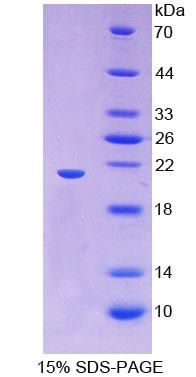 HMMR / CD168 / RHAMM Protein - Recombinant  Hyaluronan Mediated Motility Receptor By SDS-PAGE