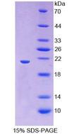 HMMR / CD168 / RHAMM Protein - Recombinant  Hyaluronan Mediated Motility Receptor By SDS-PAGE
