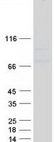 HMMR / CD168 / RHAMM Protein - Purified recombinant protein HMMR was analyzed by SDS-PAGE gel and Coomassie Blue Staining