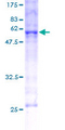 HMOX1 / HO-1 Protein - 12.5% SDS-PAGE of human HMOX1 stained with Coomassie Blue