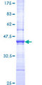 HMOX1 / HO-1 Protein - 12.5% SDS-PAGE Stained with Coomassie Blue.