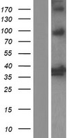 HMOX2 / Heme Oxygenase 2 Protein - Western validation with an anti-DDK antibody * L: Control HEK293 lysate R: Over-expression lysate