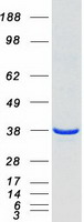 HMOX2 / Heme Oxygenase 2 Protein - Purified recombinant protein HMOX2 was analyzed by SDS-PAGE gel and Coomassie Blue Staining