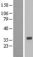 HMT / HNMT Protein - Western validation with an anti-DDK antibody * L: Control HEK293 lysate R: Over-expression lysate