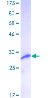 HMT / HNMT Protein - 12.5% SDS-PAGE of human HNMT stained with Coomassie Blue