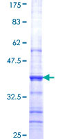 HMT / HNMT Protein - 12.5% SDS-PAGE Stained with Coomassie Blue.