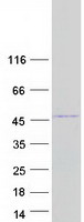 HMX1 Protein - Purified recombinant protein HMX1 was analyzed by SDS-PAGE gel and Coomassie Blue Staining