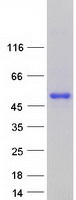 HMX3 Protein - Purified recombinant protein HMX3 was analyzed by SDS-PAGE gel and Coomassie Blue Staining